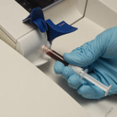 Arterial Blood Gases and Acid base balance